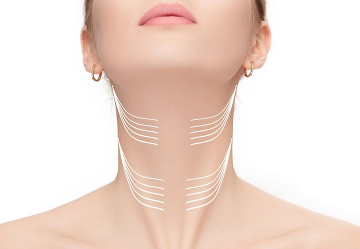 نحوه جراحی لیفت گردن 