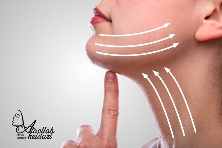 پیشگیری و کاهش عوارض جراحی لیفت گردن