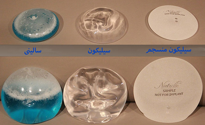 انواع پروتز سینه از نظر جنس