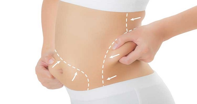 هزینه پیکر تراشی در تهران