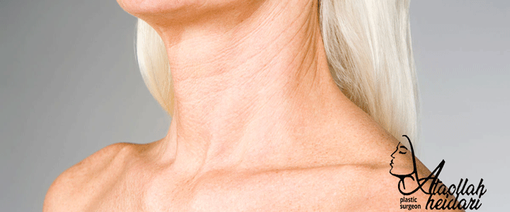 رفع پیری پوست گردن از اهداف جراحی لیفت گردن است.
