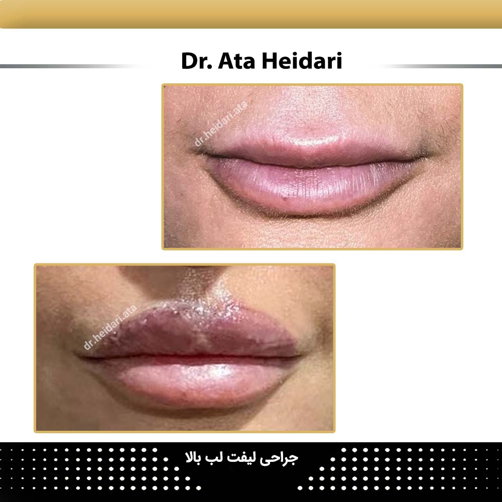 سانترال لب