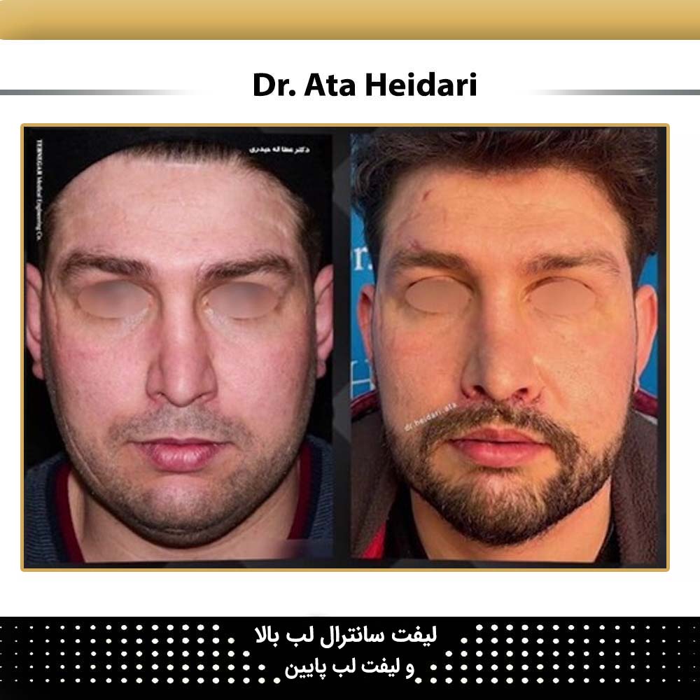سانترال لب
