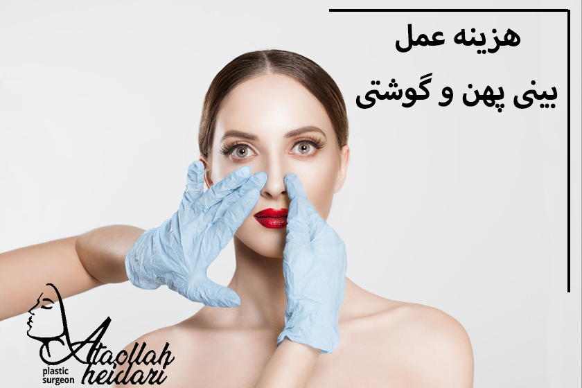 هزینه عمل بینی پهن و گوشتی