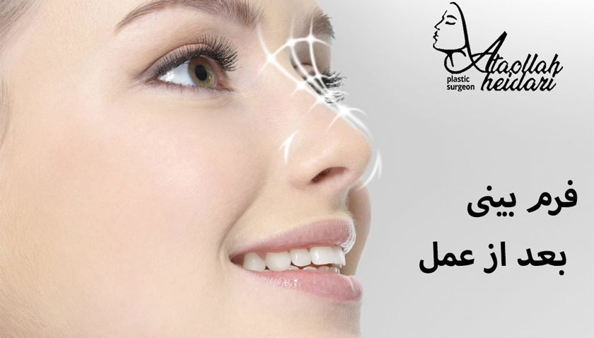 فرم بینی بعد از عمل