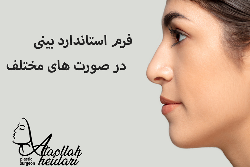 فرم بینی استاندارد
