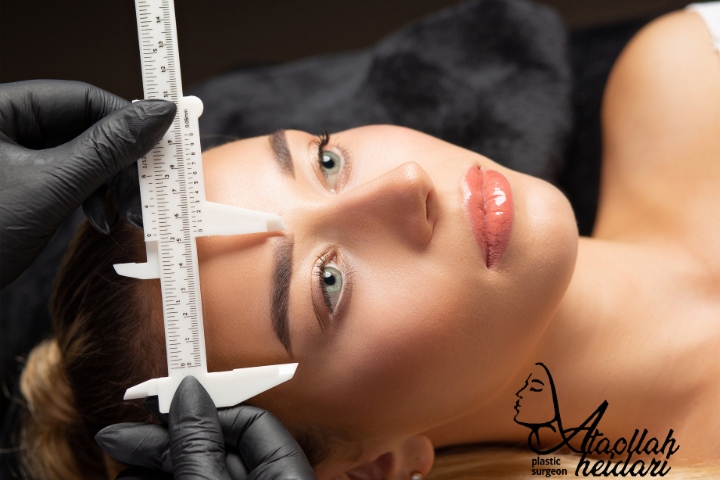 لیفت آندوسکوپی ابرو