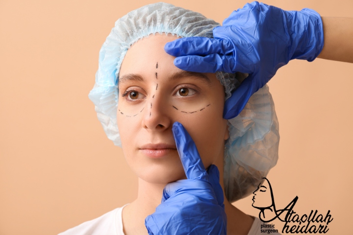 لیفت آندوسکوپی ابرو