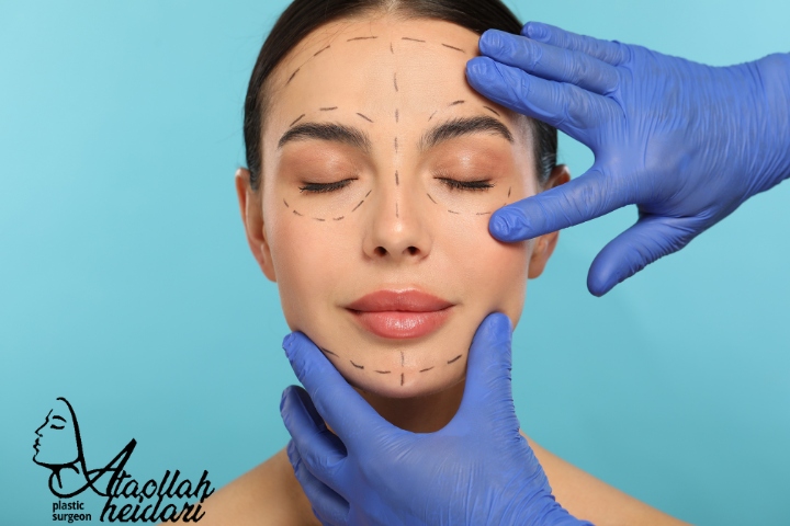 لیفت آندوسکوپی ابرو