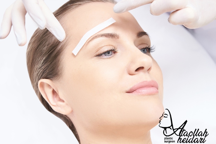 لیفت آندوسکوپی ابرو