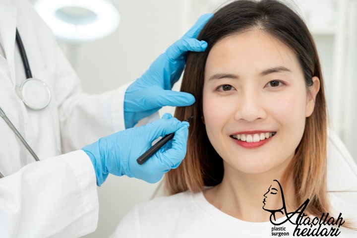 لیفت آندوسکوپی ابرو