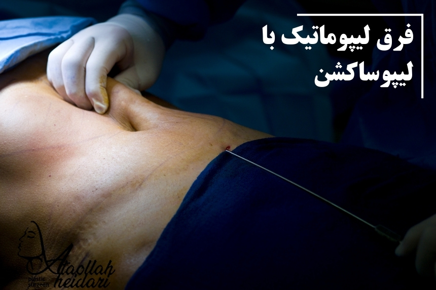 فرق لیپوماتیک با لیپوساکشن