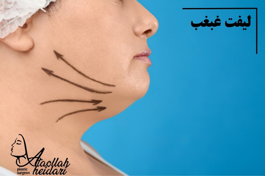 لیفت غبغب برای رفع غبغب در افراد