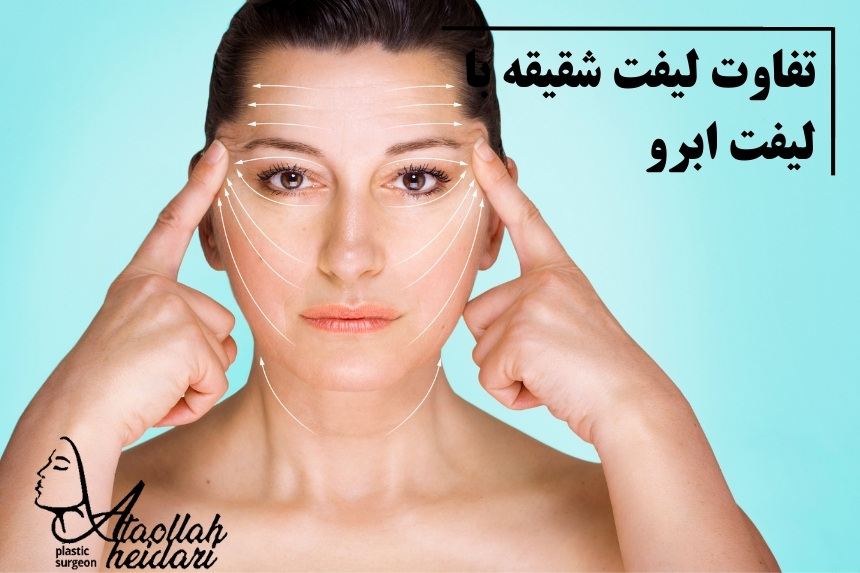 تفاوت لیفت شقیقه با لیفت ابرو