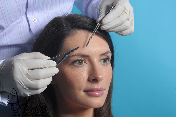 استفاده از روغنهای گیاهی و طبیعی برای رفع جای بخیه لیفت ابرو