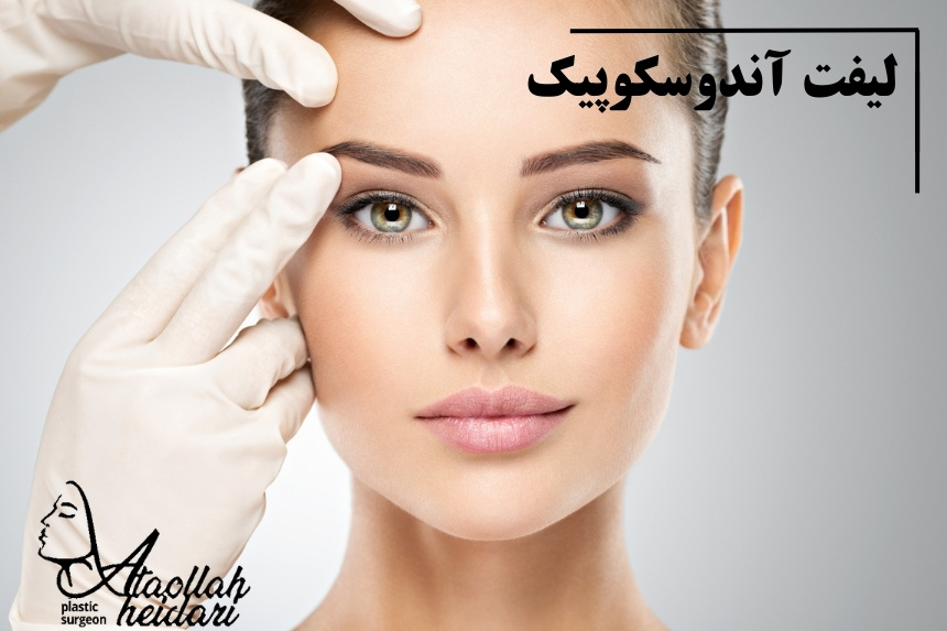 لیفت آندوسکوپیک