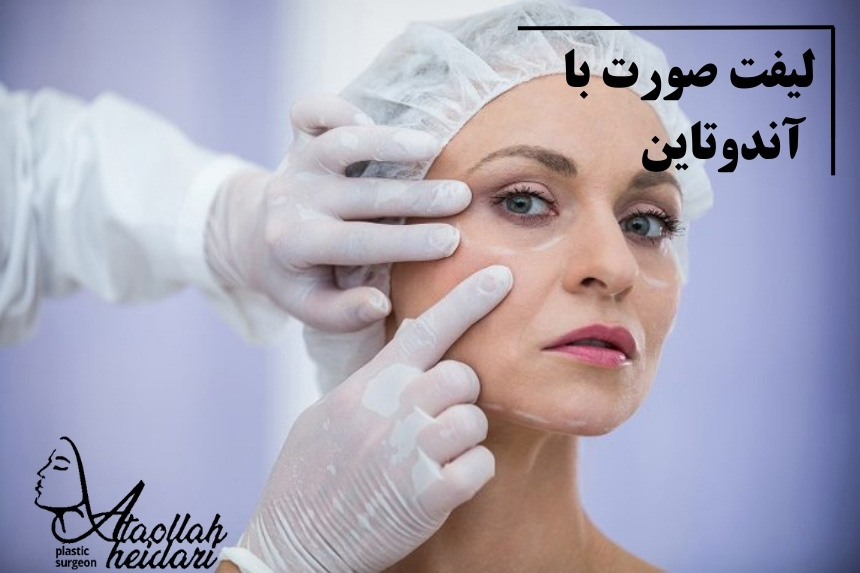لیفت صورت با آندوتاین