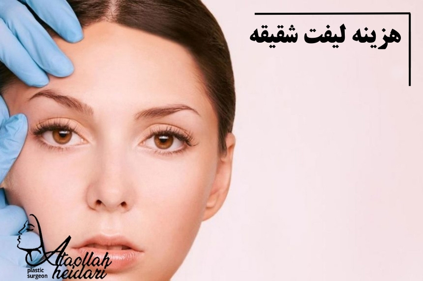 هزینه لیفت شقیقه در سال 1404