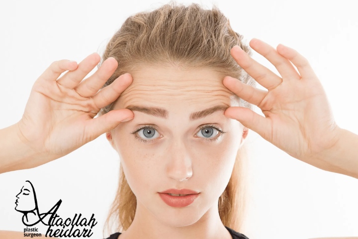 هزینه لیفت شقیقه به میزان افتادگی پوست بستگی دارد