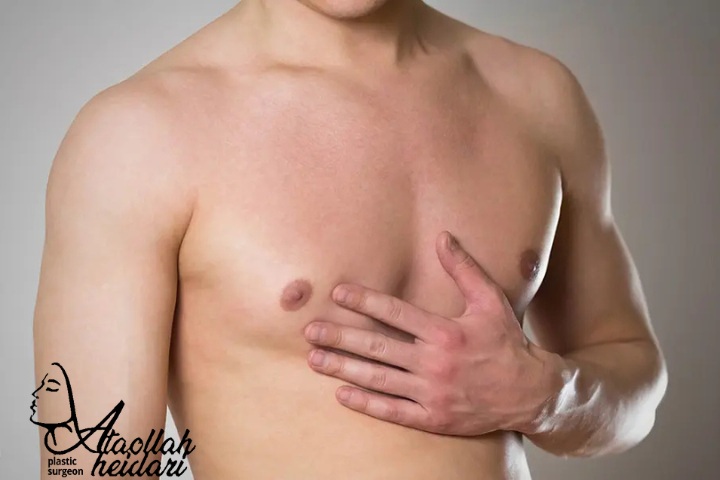 هزینه عمل ژنیکوماستی