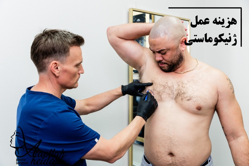 هزینه عمل ژنیکوماستی در سال 1404