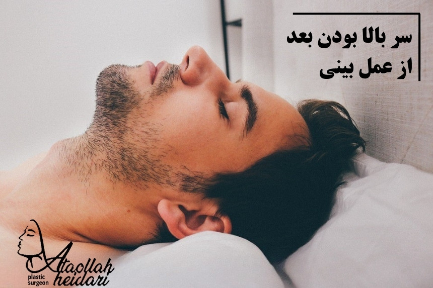 تا چند روز بعد عمل بینی باید سربالا باشد