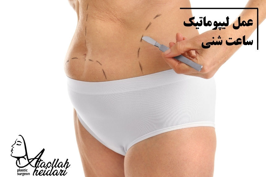 عمل لیپوماتیک ساعت شنی
