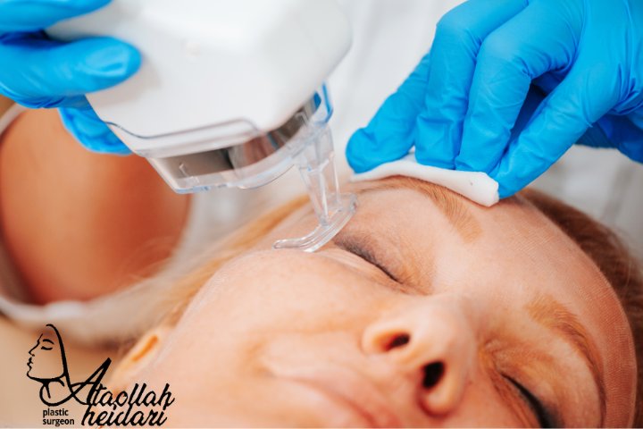 جوانسازی با ار اف فرکشنال