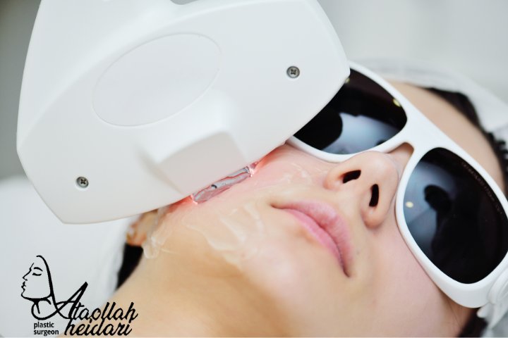 جوانسازی با ار اف فرکشنال