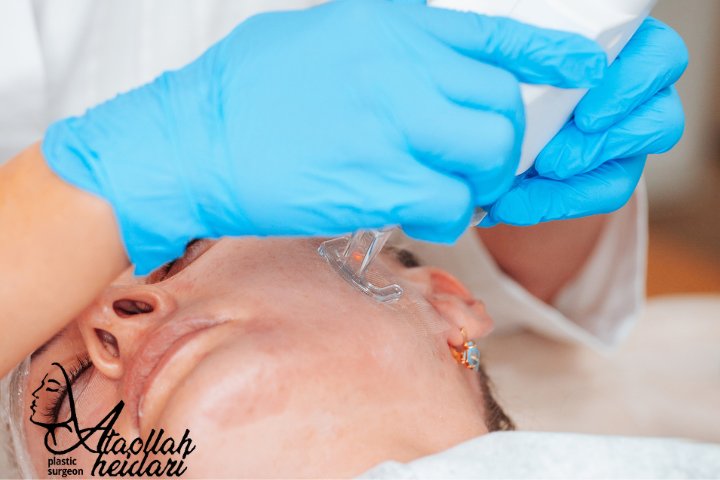 جوانسازی با آر اف فرکشنال بدون سوزن