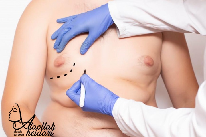 چه زمانی باید برای ژنیکوماستی به پزشک مراجعه کرد