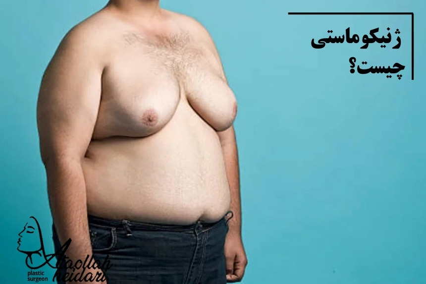 ژنیکوماستی چیست