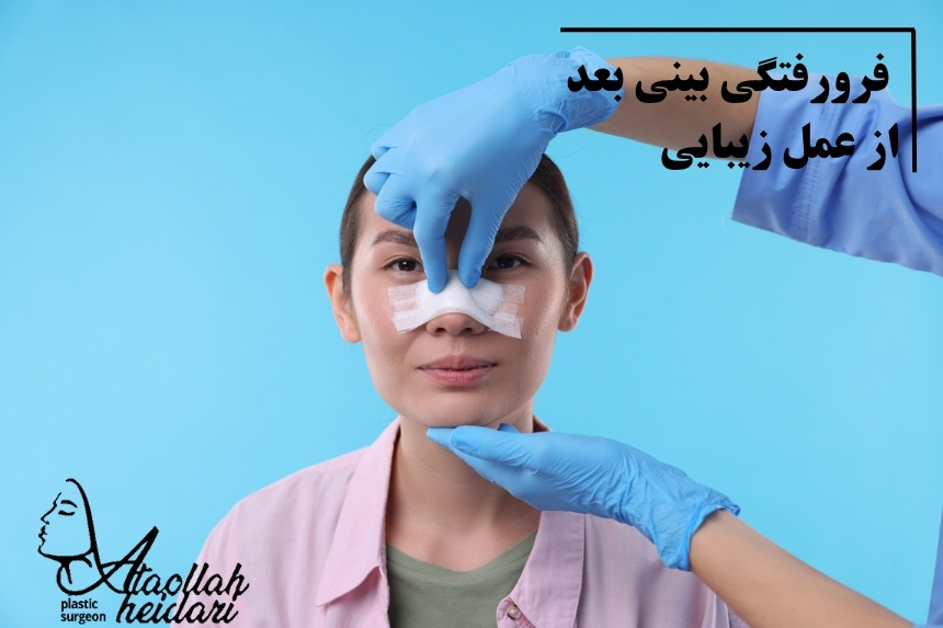 فرورفتگی بینی بعد از عمل زیبایی