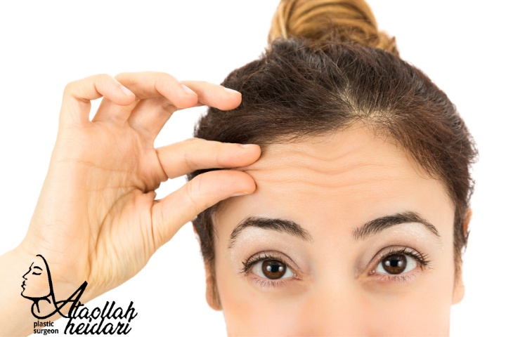 هزینه لیفت آندوسکوپی شقیقه