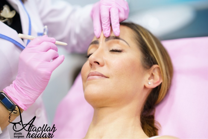 لیفت اندوسکوپیک شقیقه