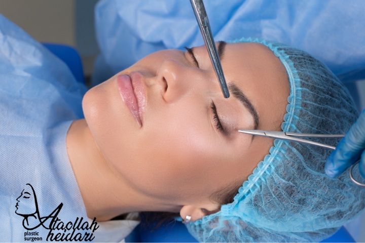 دوران نقاهت بعد از بلفاروپلاستی چقدر طول میکشد