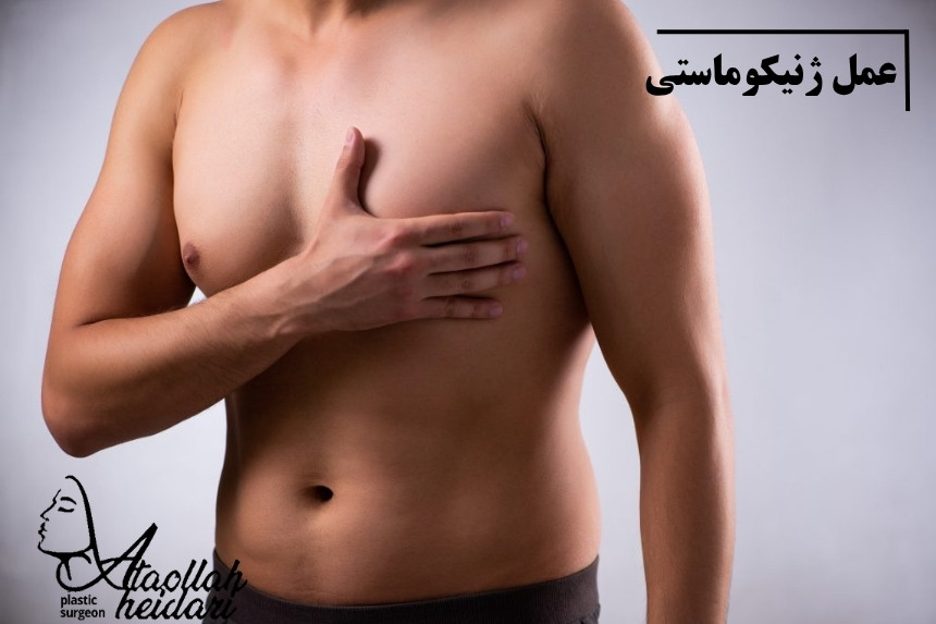 عمل ژنیکوماستی