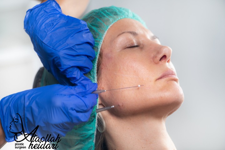 همه چیز درباره لیفت صورت