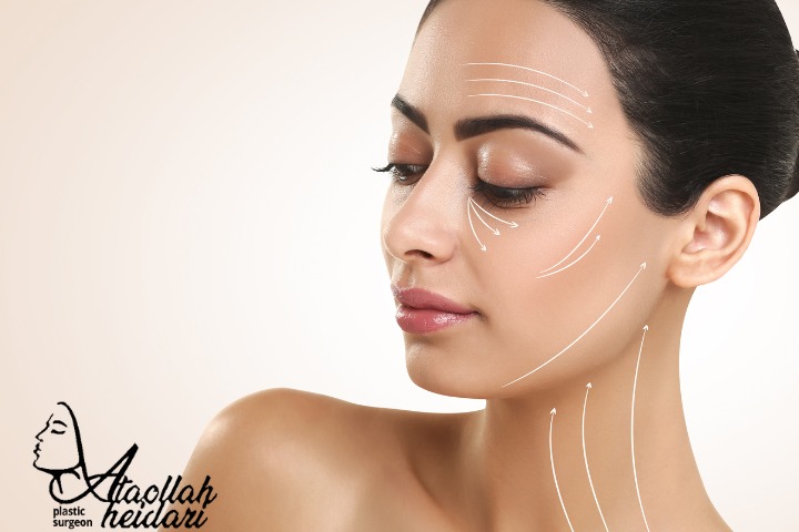 همه چیز درباره لیفت صورت