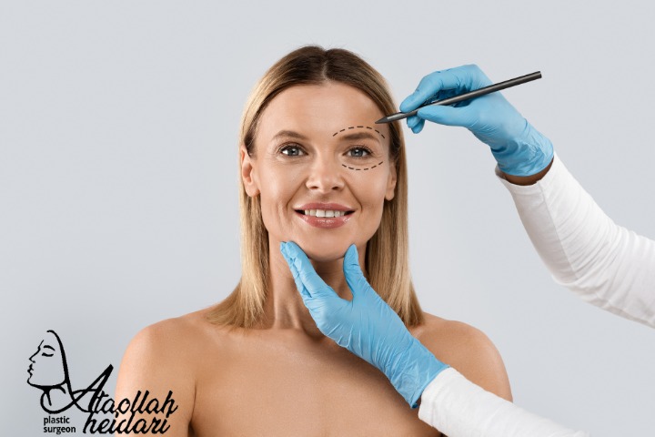 همه چیز درباره لیفت صورت