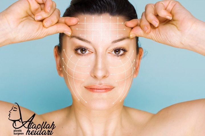 همه چیز درباره لیفت صورت