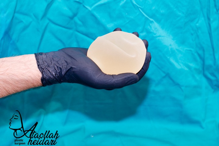 مراقبت های قبل از عمل پروتز سینه