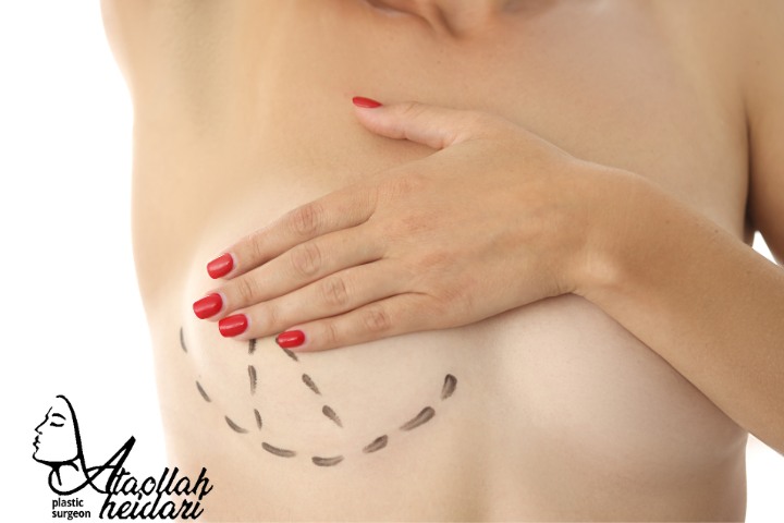 محل قرار گیری پروتز سینه