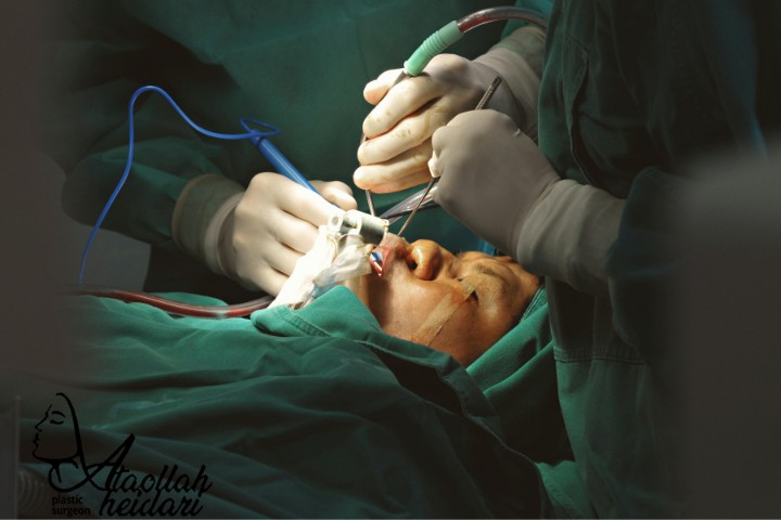 انتخاب بهترین جراح بینی مناسب خود