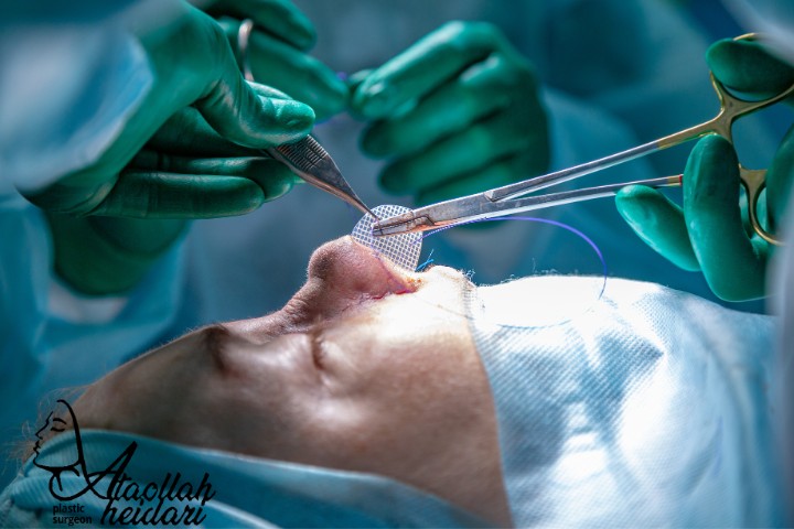 بهترین جراح بینی در تهران