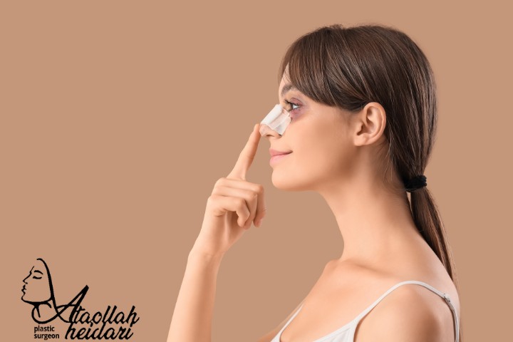 مراقبت های بعد از عمل رینوپلاستی