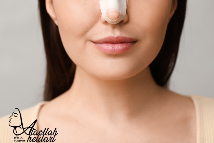 نکاتی درباره عمل بینی و هزینه آن