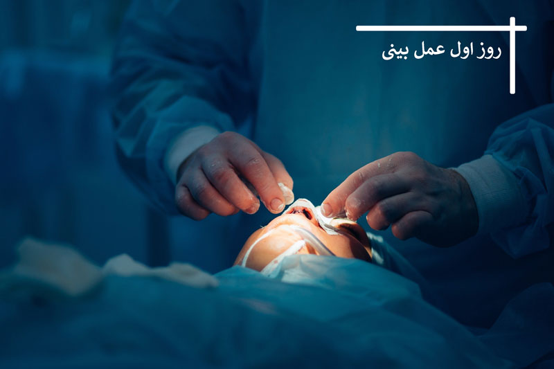 روز اول عمل بینی